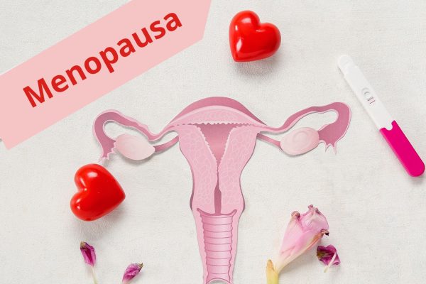 Menopausa