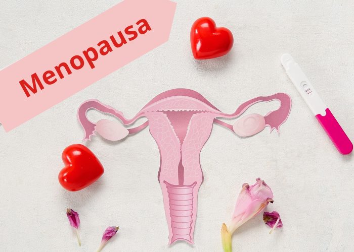 Menopausa